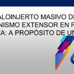 Aloinjerto masivo mecanismo extensor rodilla nativa